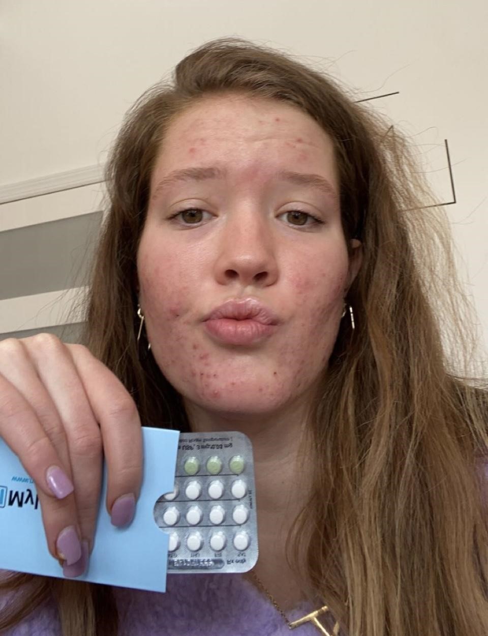 alexa-borth-control-pills