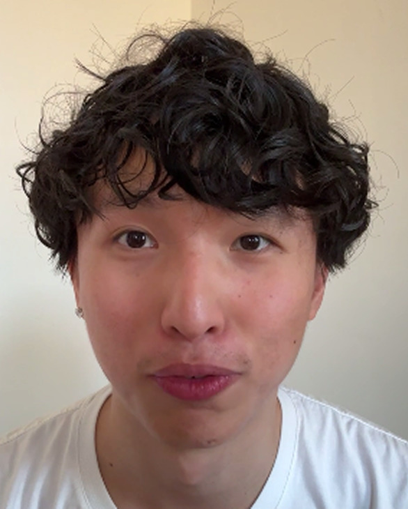 Marco Mei after treatment