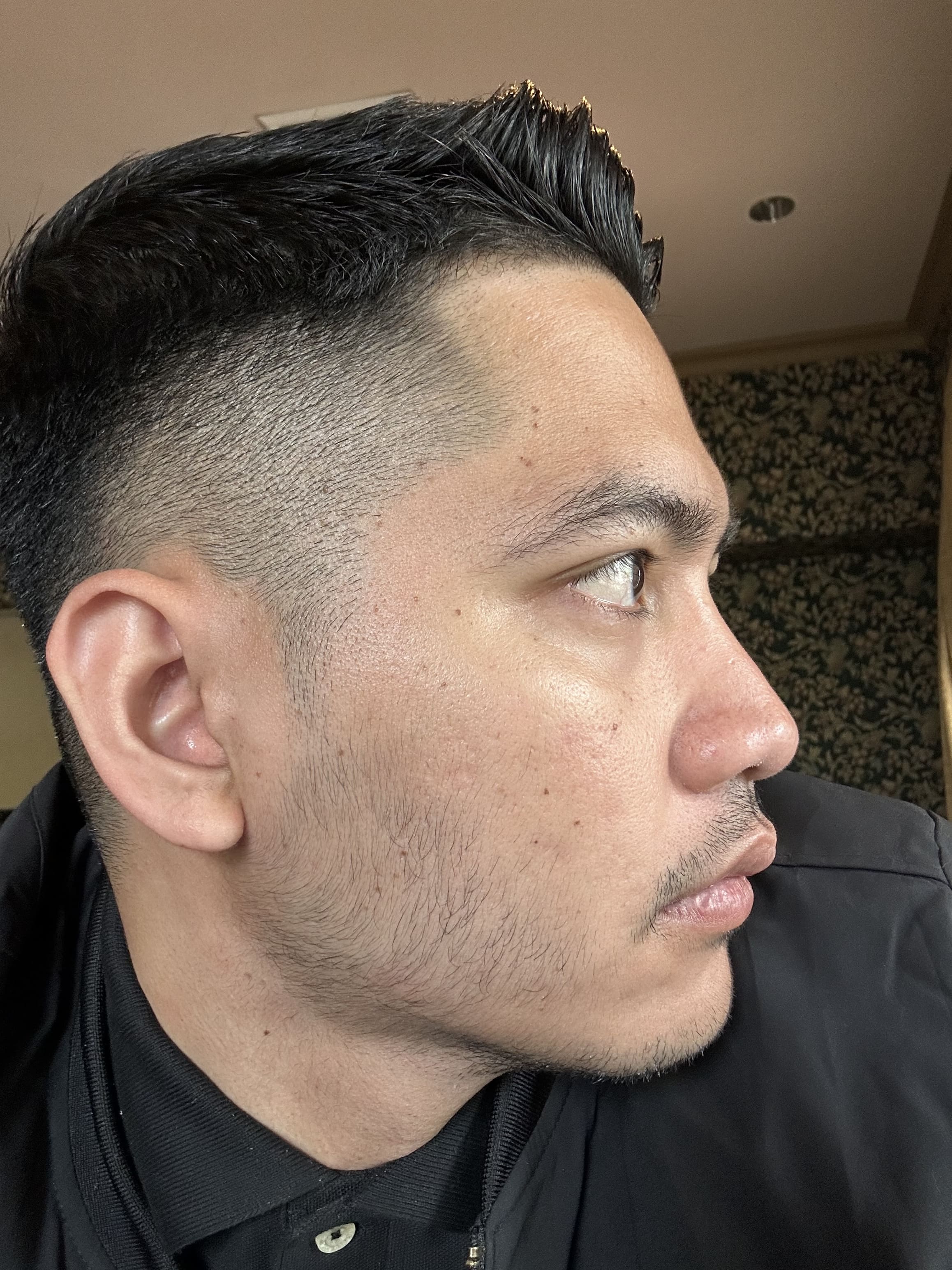 Jamery after treatment