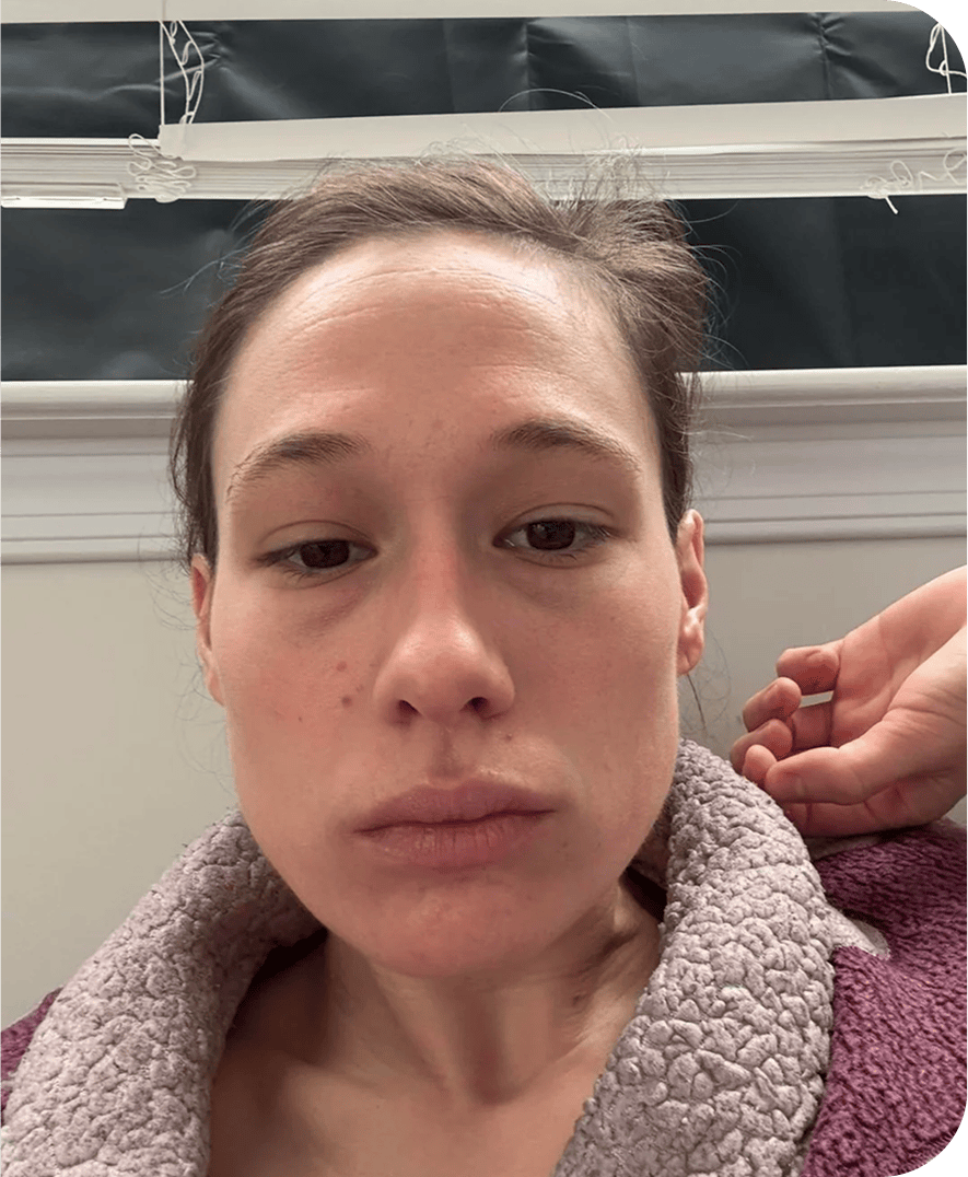 Brooke after treatment
