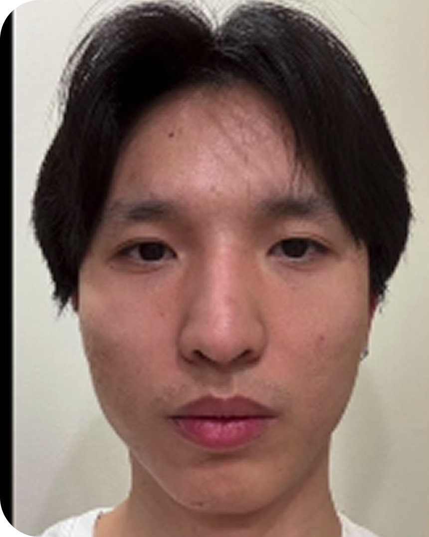 Marco Mei before treatment