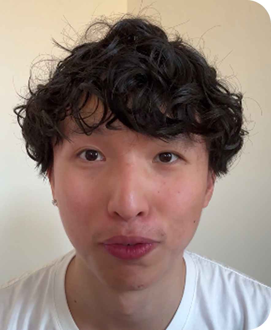 Marco Mei after treatment