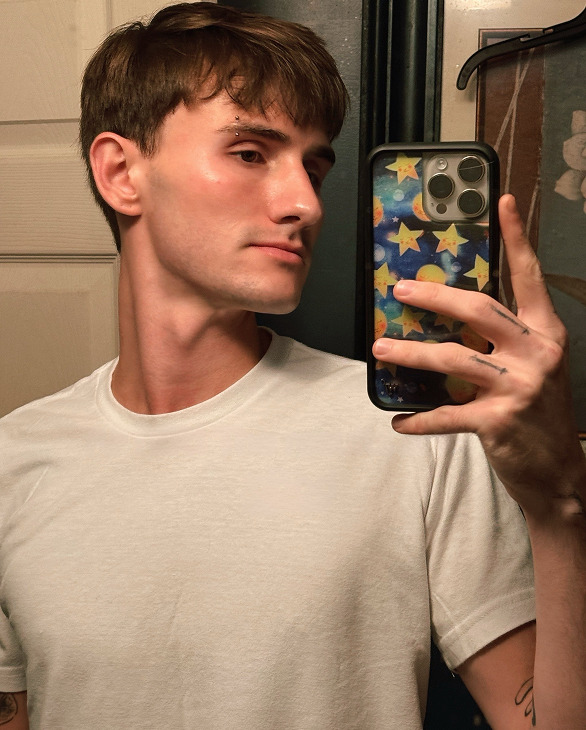 Ian H. after treatment